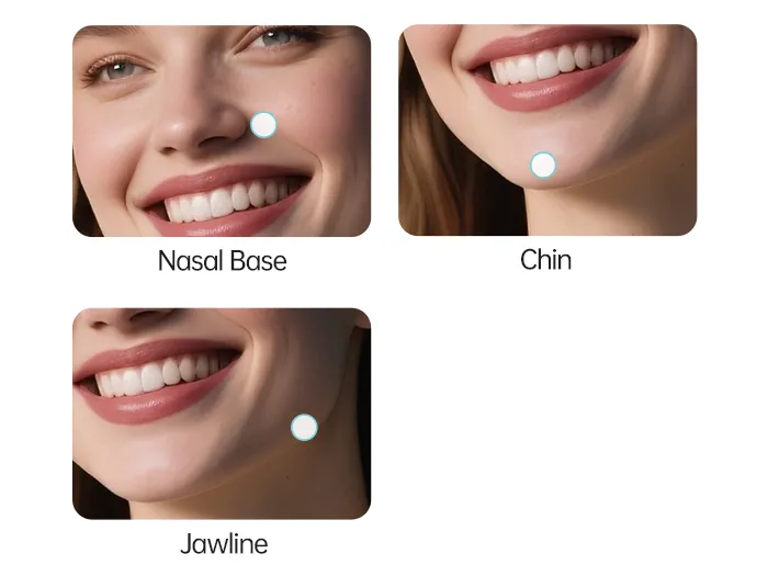hyaluronic acid facial filler